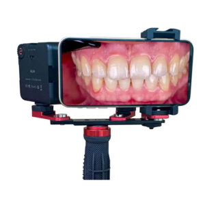 Dental intraoral photography mobile phone fill light portable
